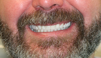 Man with straight healthy smile