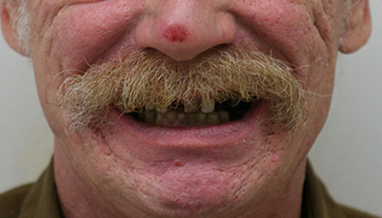 Man with damaged and missing teeth